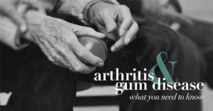 Arthritis gum disease
