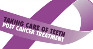 Caring for teeth post cancer graphic