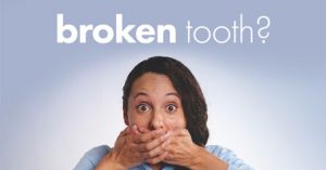 Treating broken teeth graphic