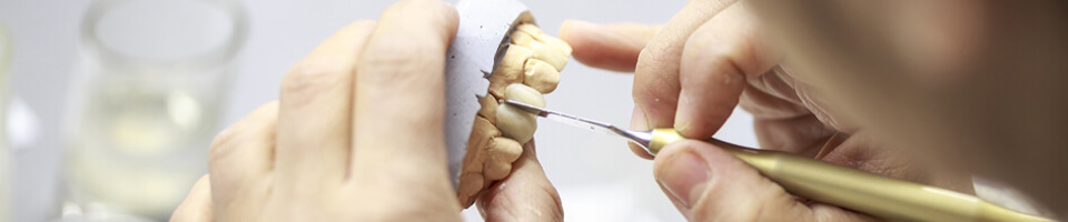 Inlays & onlays repair teeth in Paxton, MA