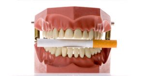 What smoking does to teeth graphic