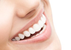 Cosmetic Dentistry Veneers in Paxton MA Area
