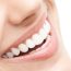 Porcelain Veneers for concealing crooked teeth