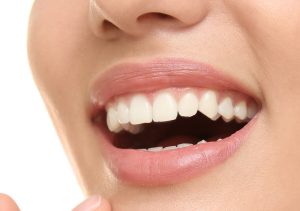 Teeth Whitening Service Near Worcester Area