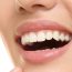 If You Are Seeking Whiter Teeth, Look into A Professional Option and Leave the Competitors on the Shelf