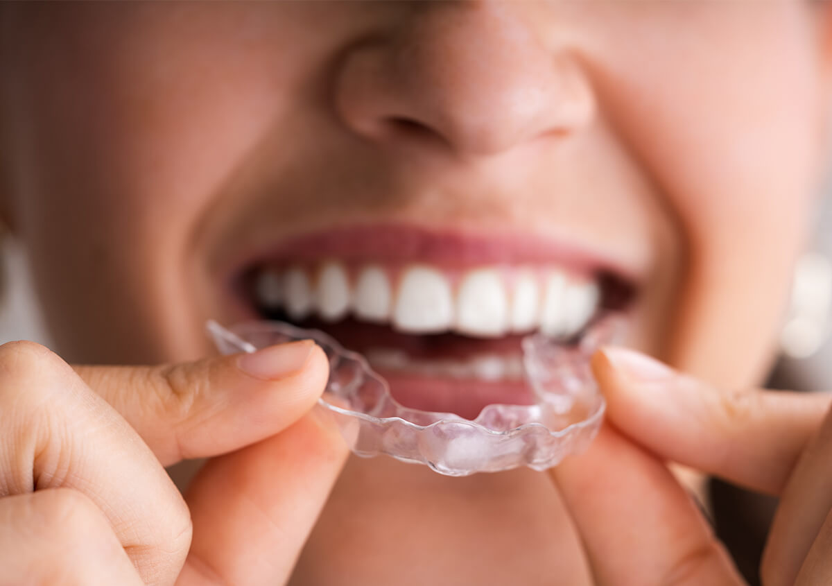 Clear Aligner Therapy in Worcester MA Area