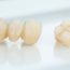 How Do CEREC Same-Day Dental Crowns Matchup with Traditional Lab Crowns?