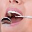 Filling cavities with composite resin versus mercury fillings